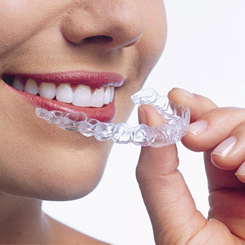 Metallbrackets